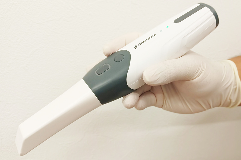 口腔内3Dスキャナー