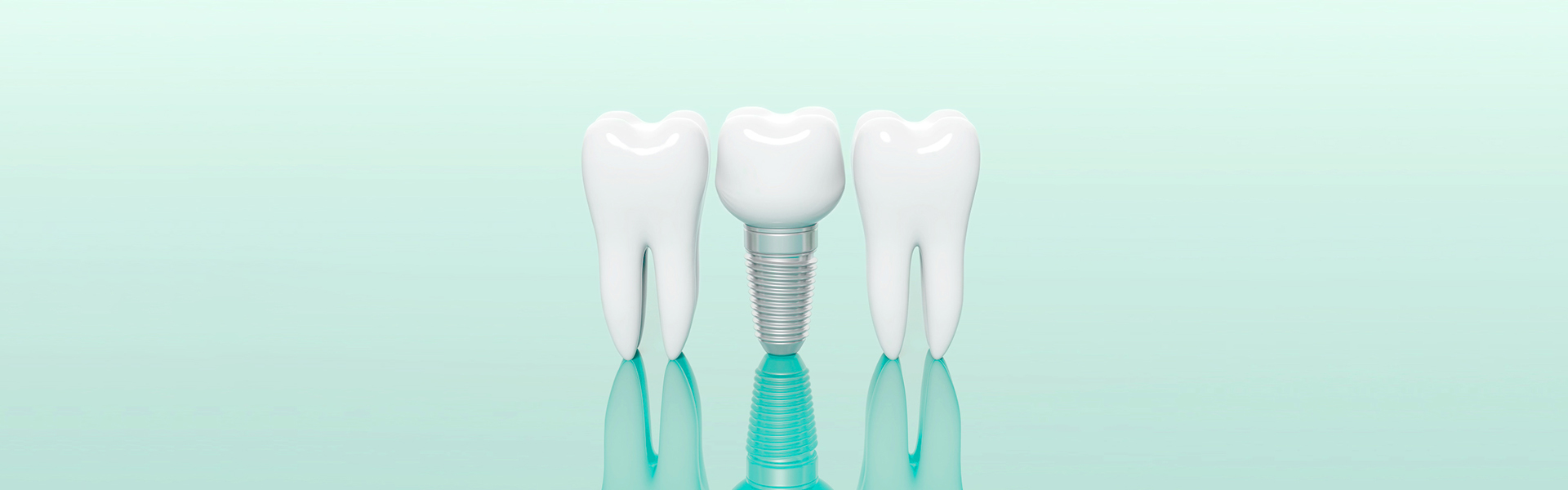 インプラントヘッダーイメージ