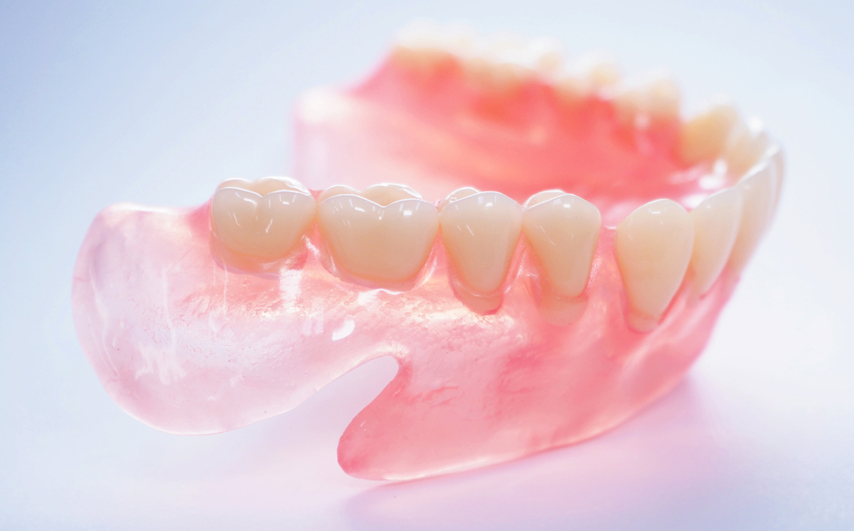 入れ歯（義歯）とは