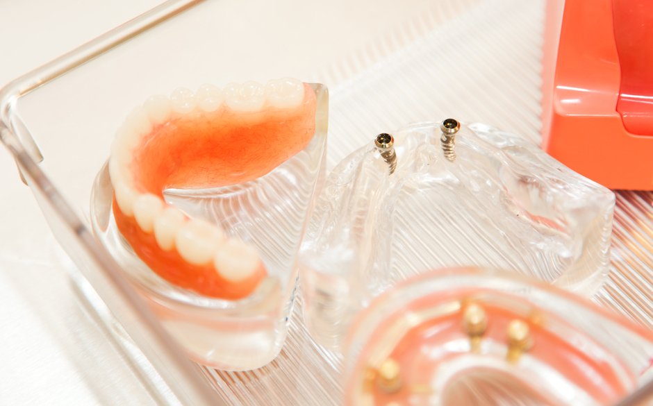 マグネットデンチャー