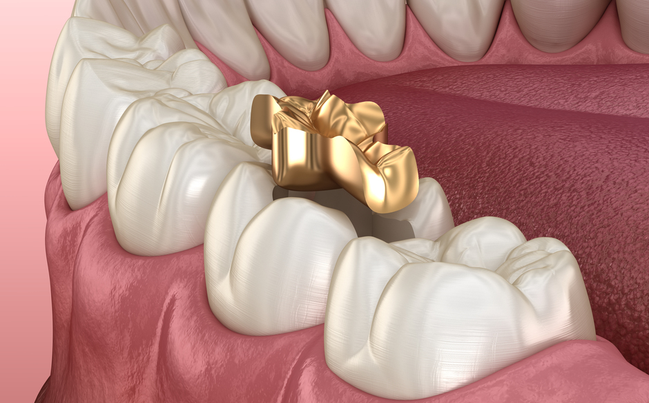 ゴールドイメージ