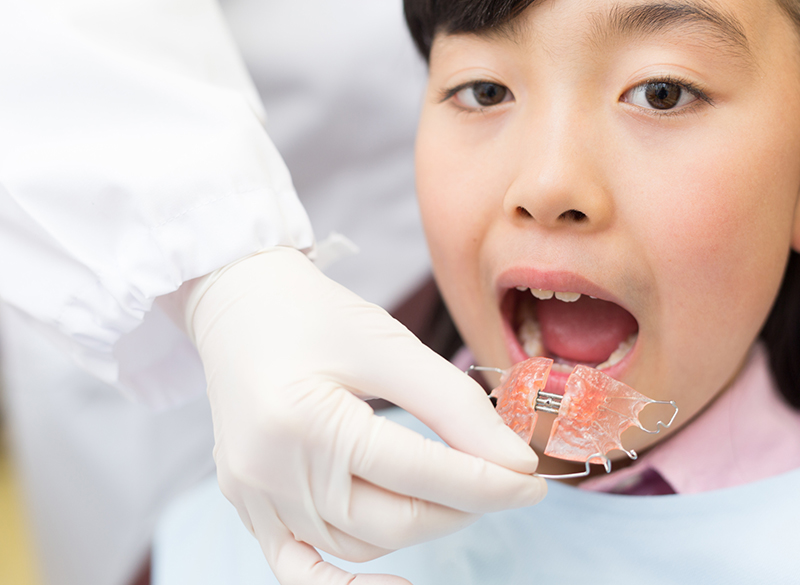 小児歯科矯正