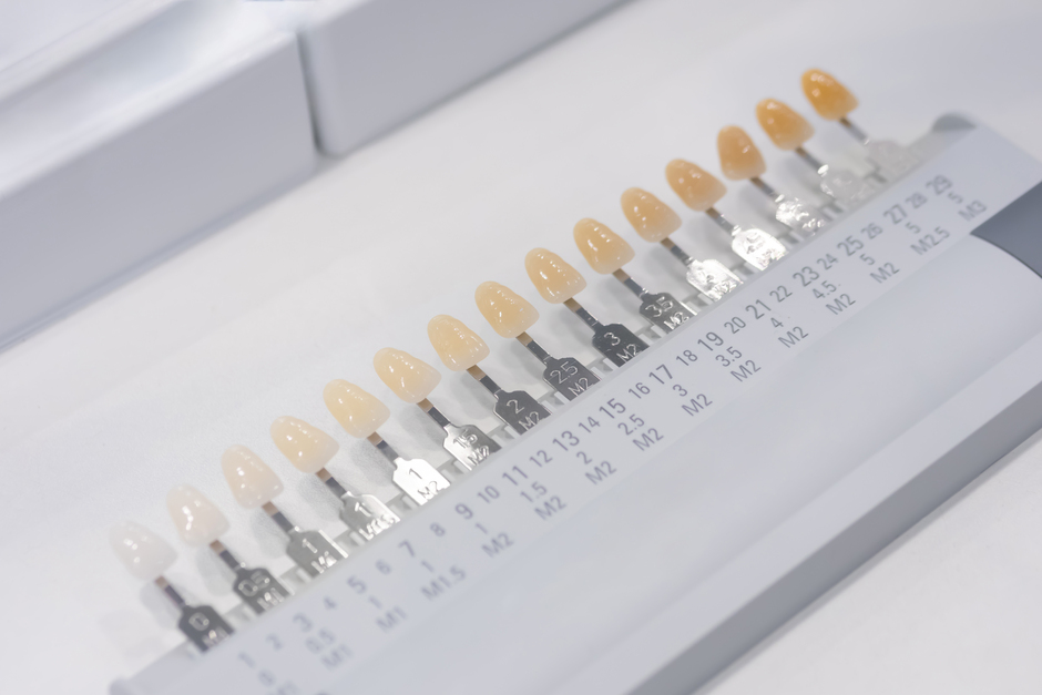 ホワイトニングとは？