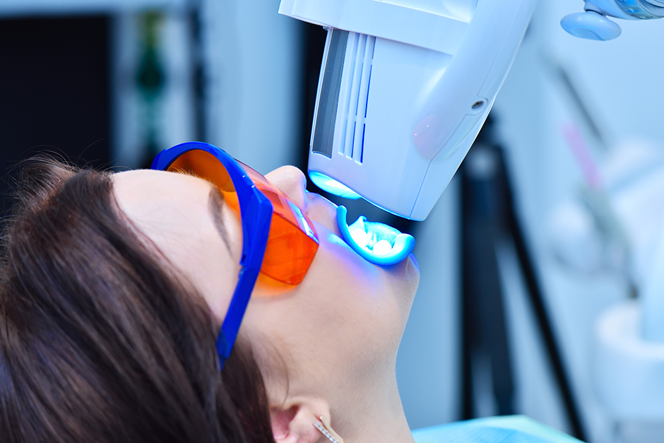 オフィスホワイトニングイメージ